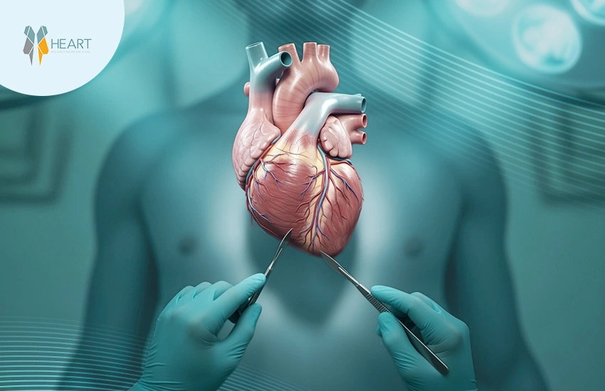 جراحة القلب المفتوح