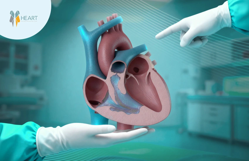 علاج ثقب القلب بين البطينين